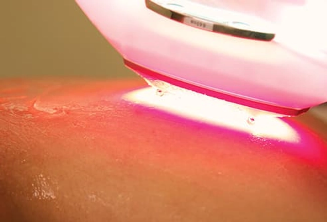 What May Help: Laser Therapy
