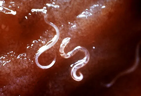 Hookworms Inside Dog