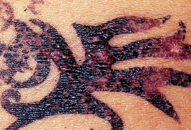 Types: Temporary Tattoos