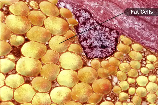 fat cells micrograph