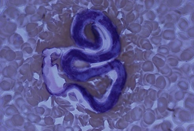 Filarial Worms