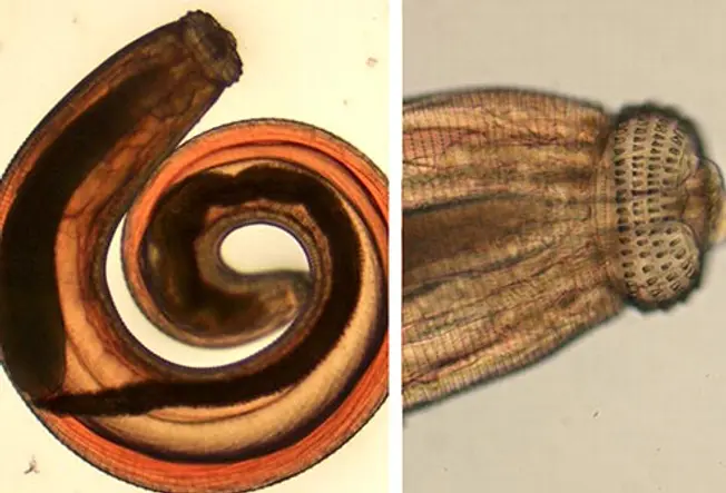 Gnathostoma Spinigerum