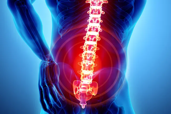 photo of spine pain
