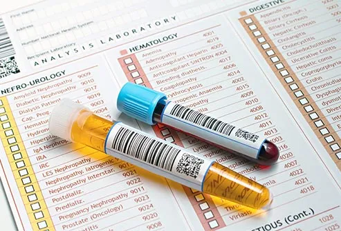 medical report urine and blood tubes