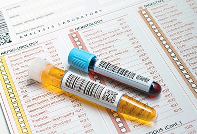 Blood and Urine Tests