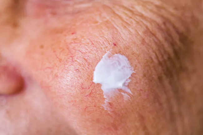photo of cream on face