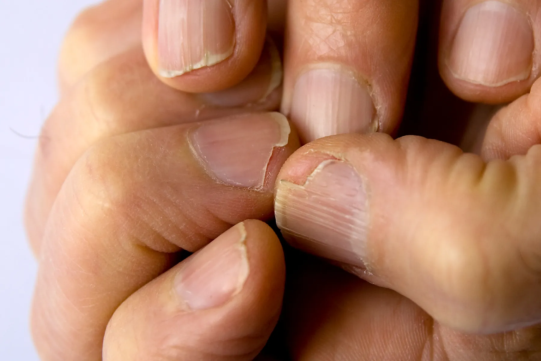 Pictures Of What Causes Brittle Nails And How To Care For Them