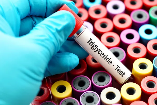 triglyceride test