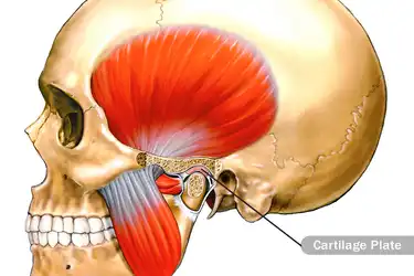 artrita temporo mandibulara cauze osteoartrita tratamentului articulațiilor cotului