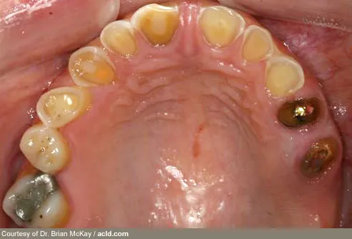 Dental Pictures: Gum Disease, Tongue Problems, Oral Cancer ...