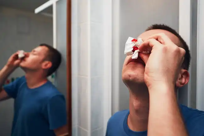 man with bloody nose