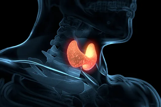 photo of thyroid