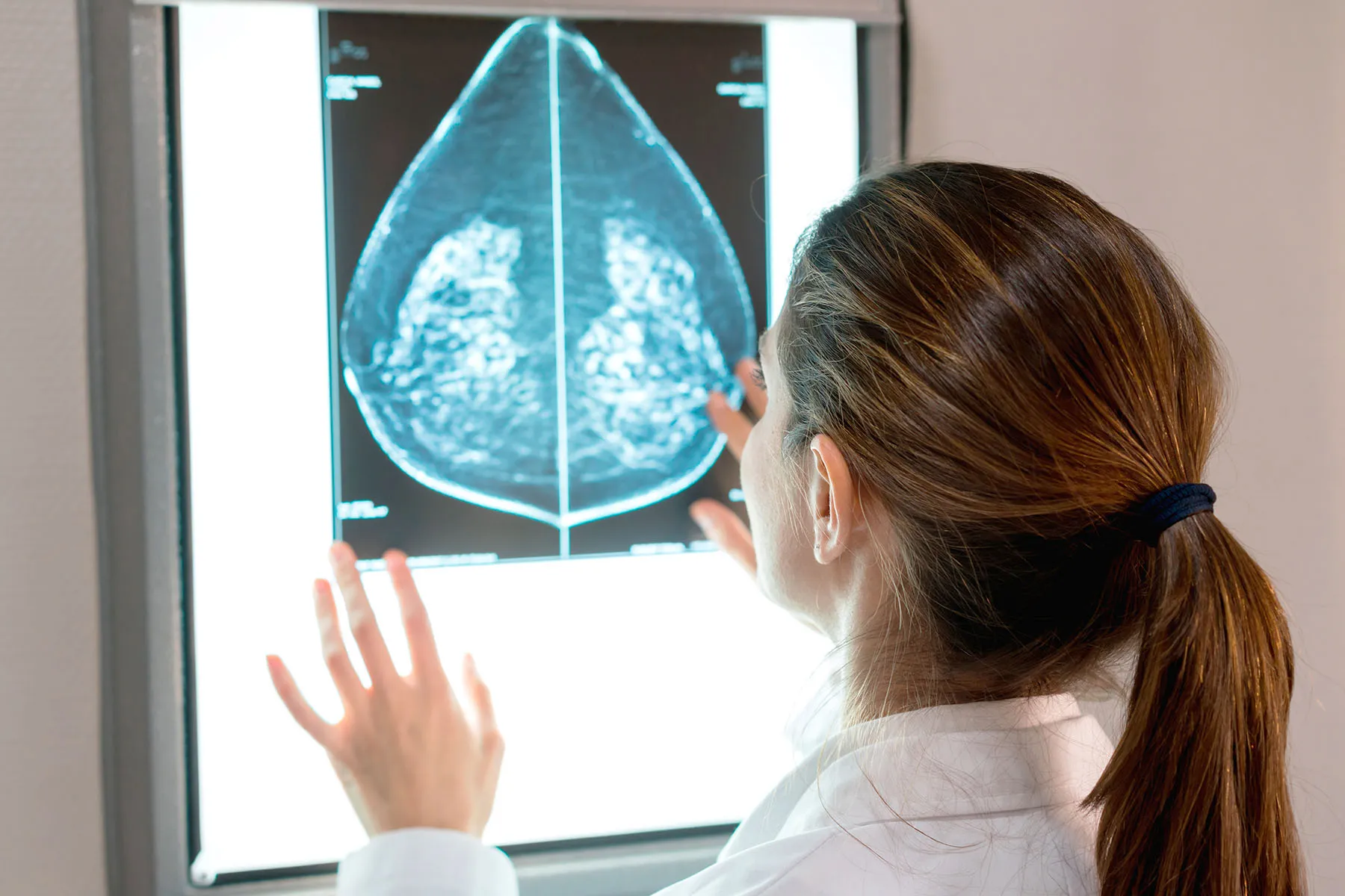 photo of gynecologist looking at a mammogram