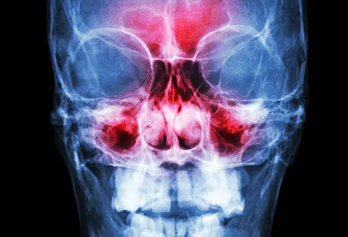 x-ray of sinuses