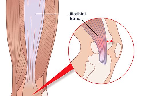 Reasons For Pain Behind In Back Of The Knee