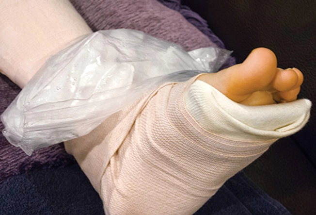 Treating a Joint Injury