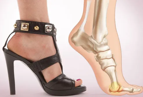 The Worst Shoes for Your Feet