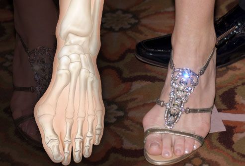 high heels for women with bunions