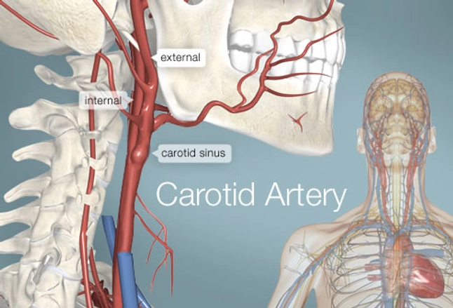 Carotid Artery Human Anatomy Picture Definition Conditions More