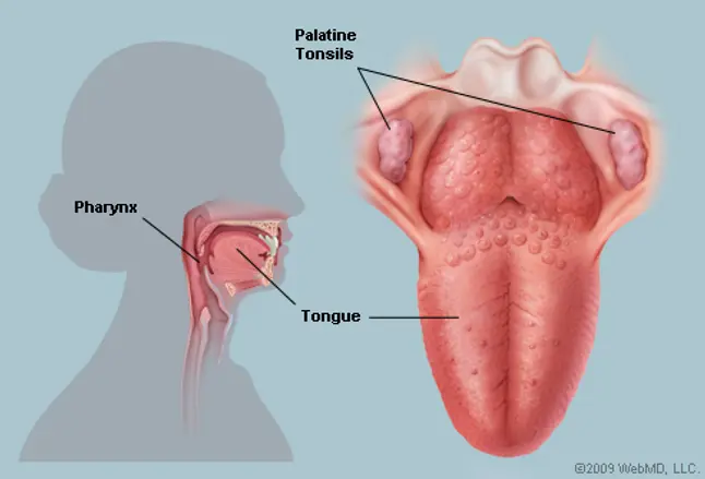 Picture of the Human Tonsils