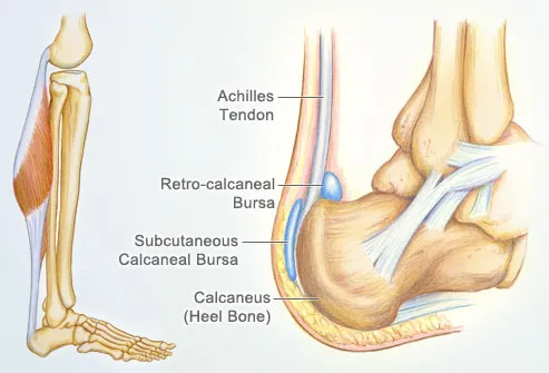 The Achilles tendon