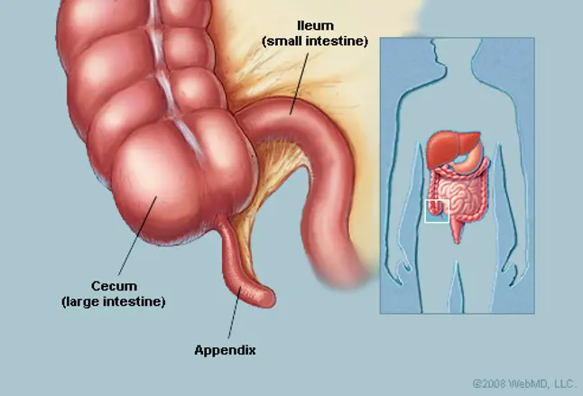 Picture of Appendix