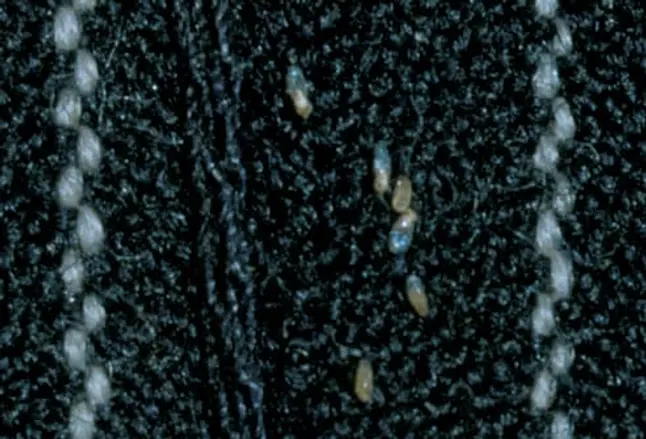 Picture of Body Lice