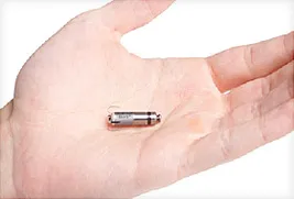 mini pacemaker