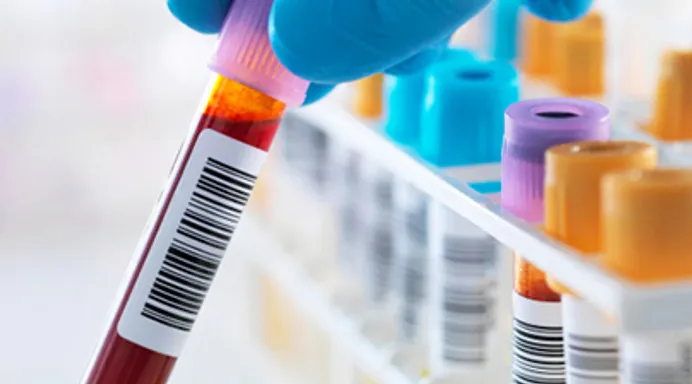 Test Your Knowledge of What Blood Tests Can Tell You