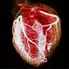 Heart Disease Overview Slideshow