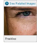 Picture of Freckles