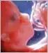 slideshow fetal development