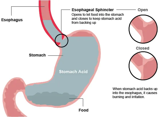 stomach diagram