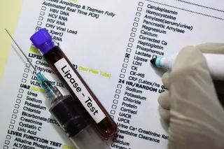 photo of Lipase - Test with blood sample.