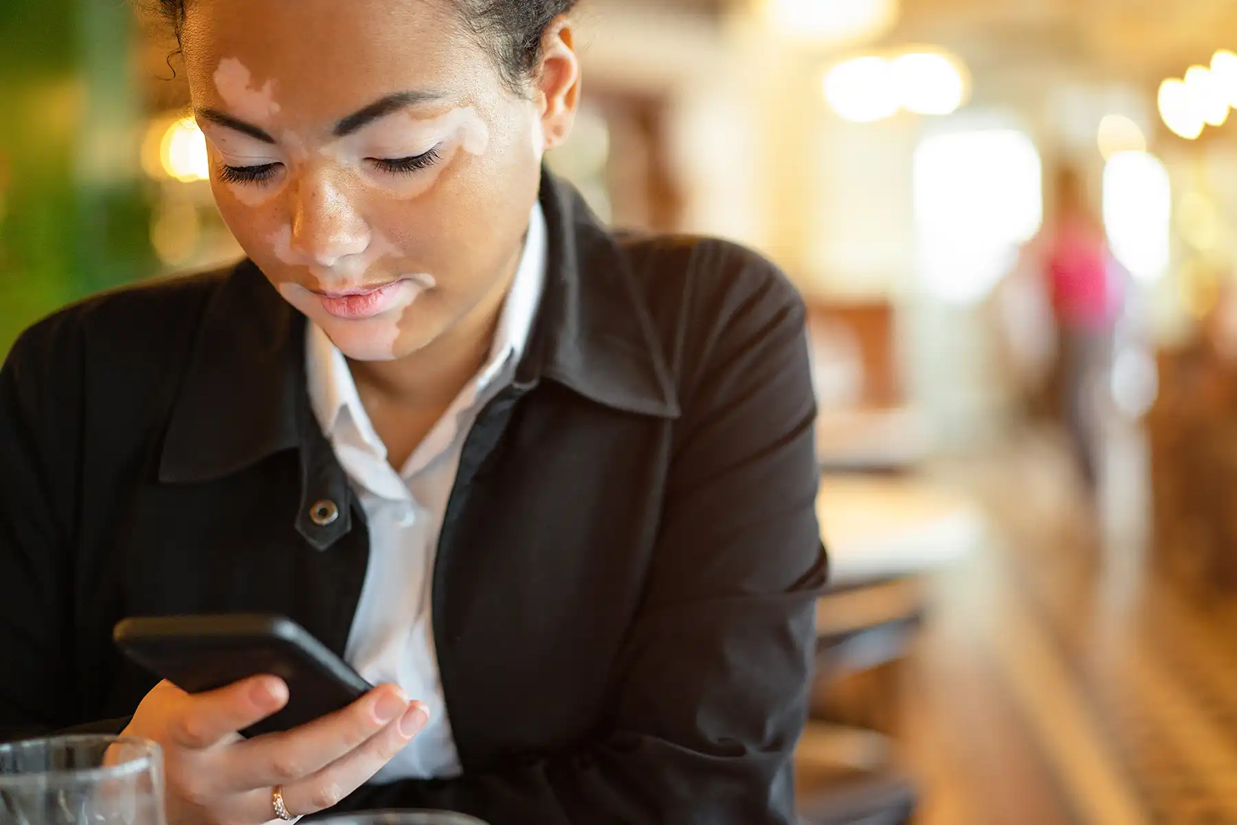 photo of woman with vitiligo texting in restaurant