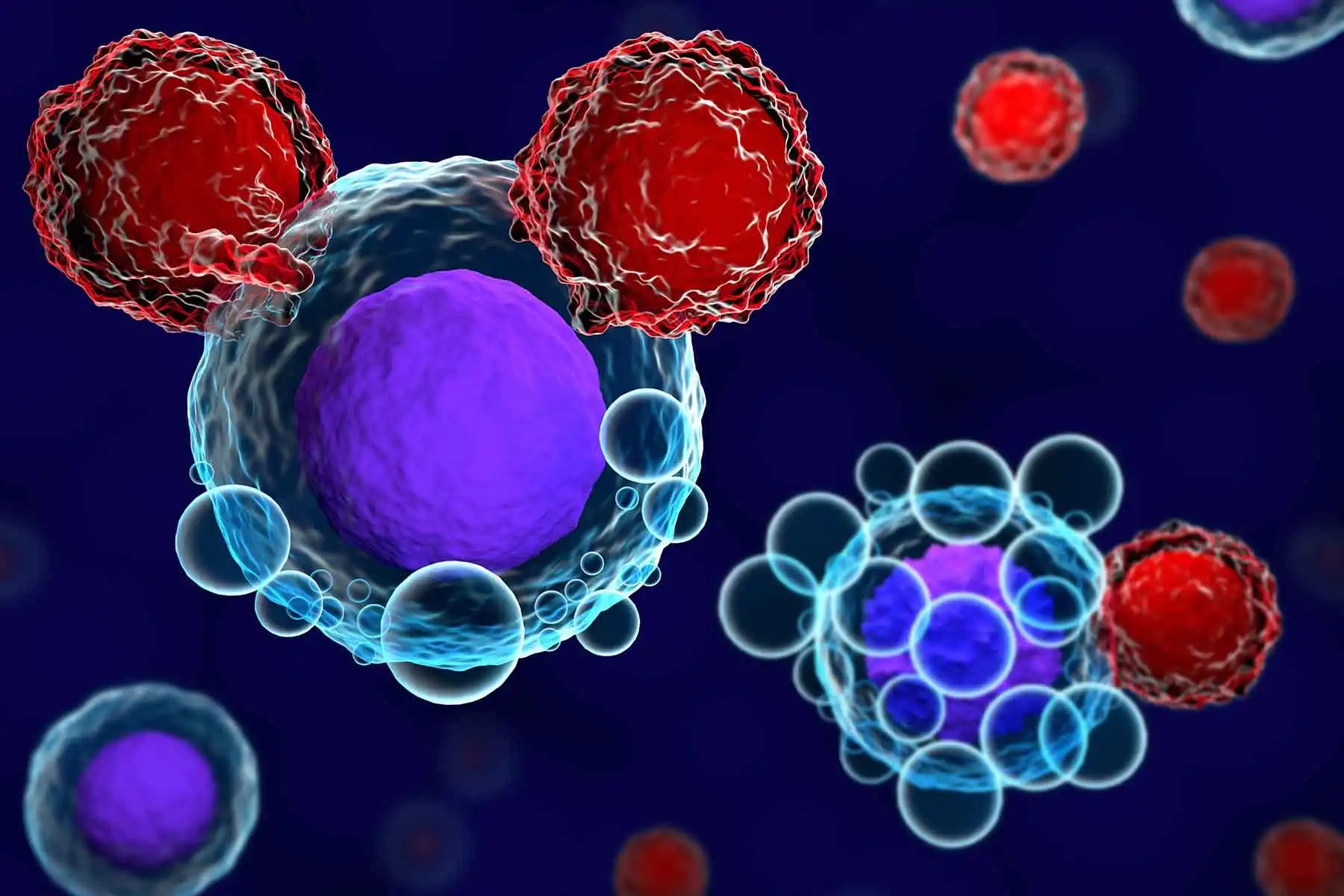 CAR T-cell therapy illustration