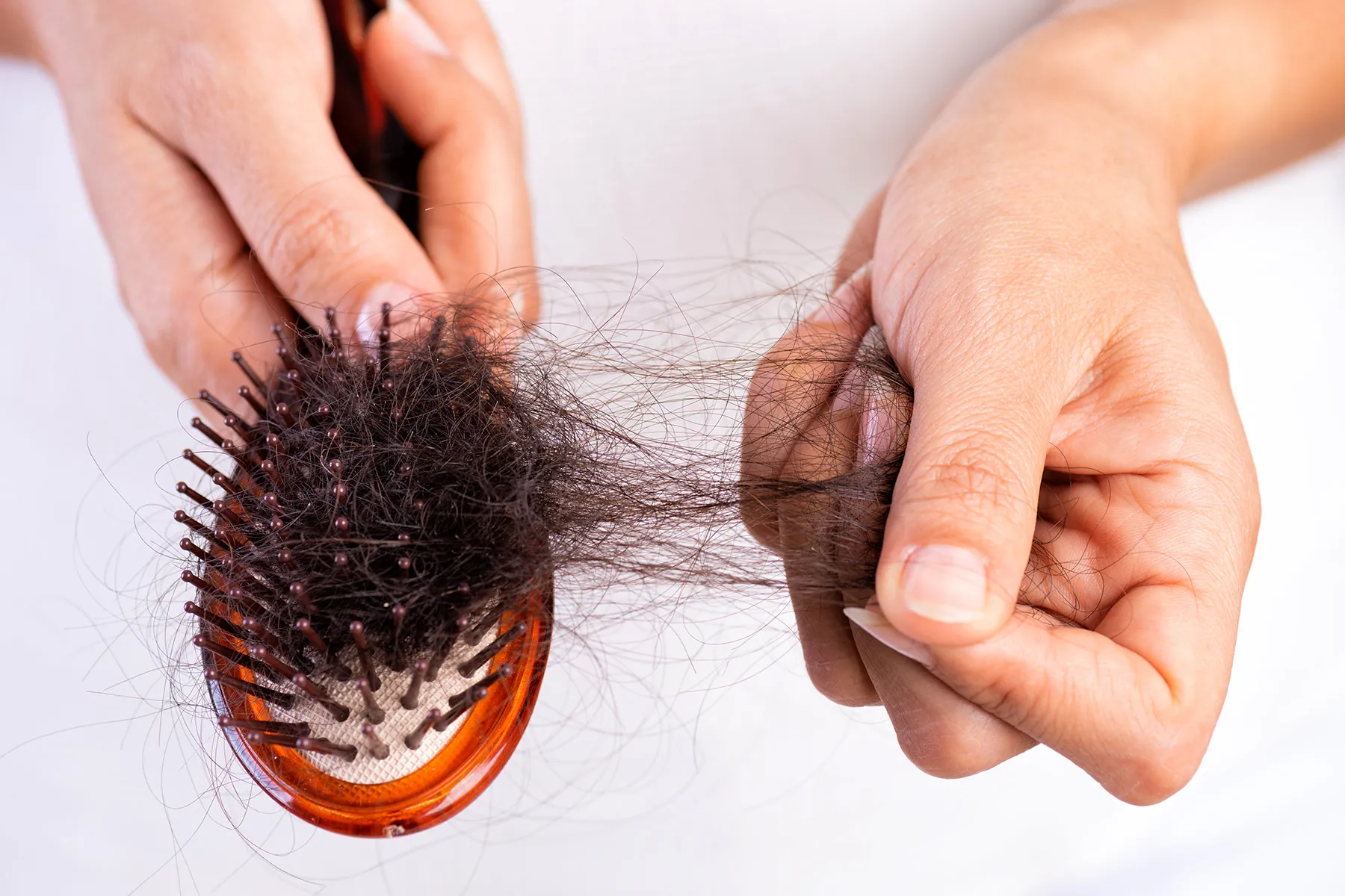 Sometimes Hair Loss in Women Can Point to Bigger Health Issues