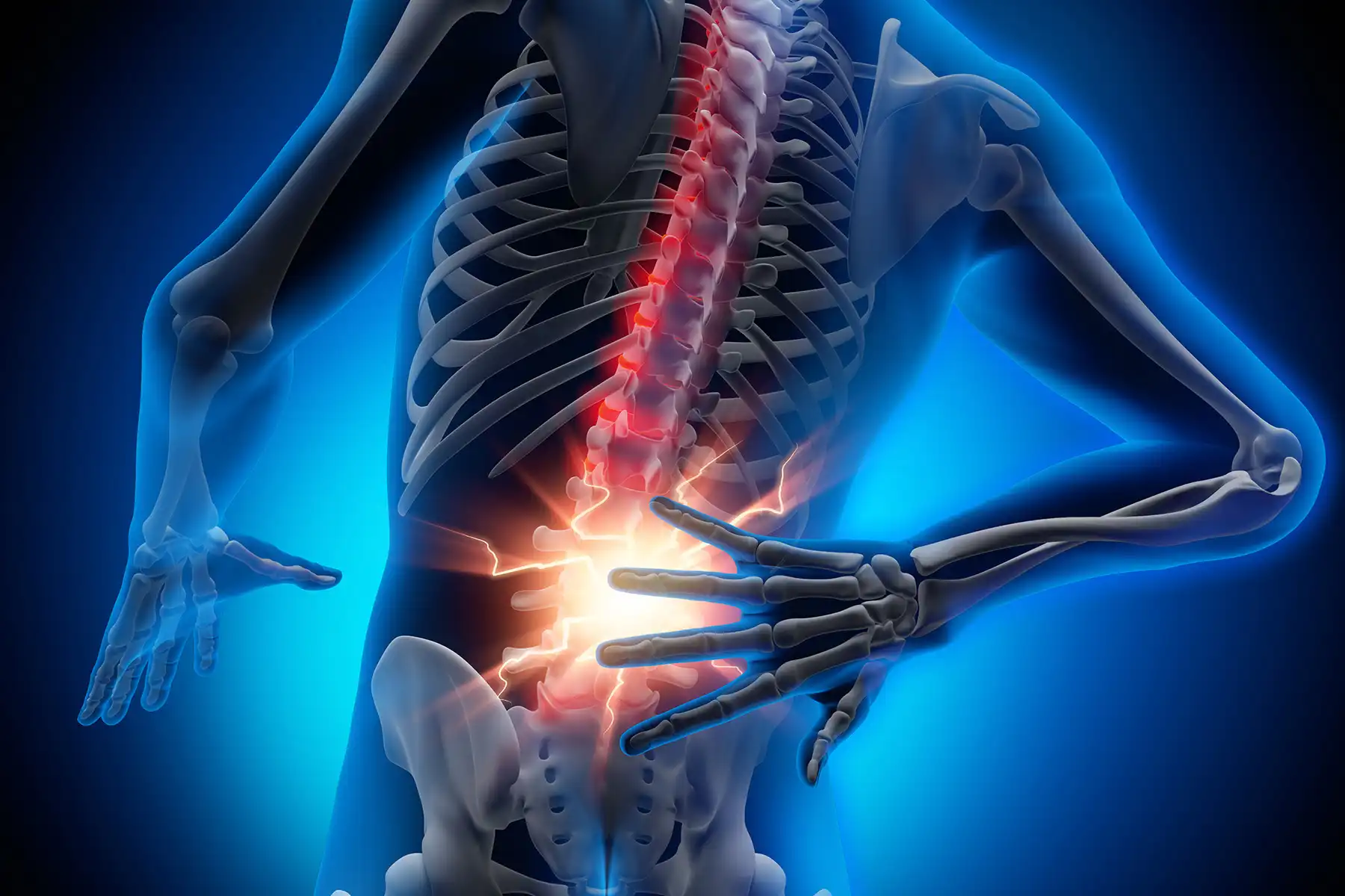 photo of medical illustration back pain
