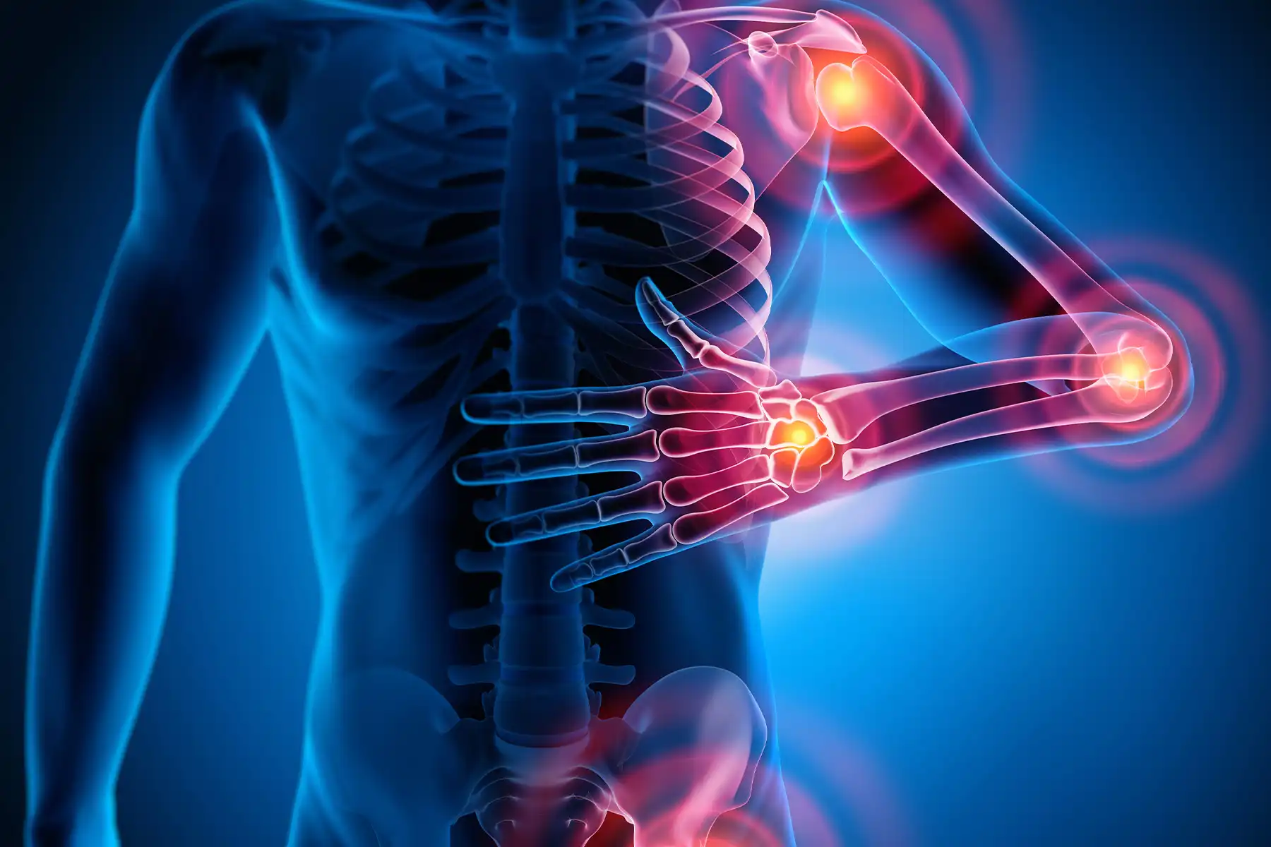 photo of medical illustration torso pain joint bla