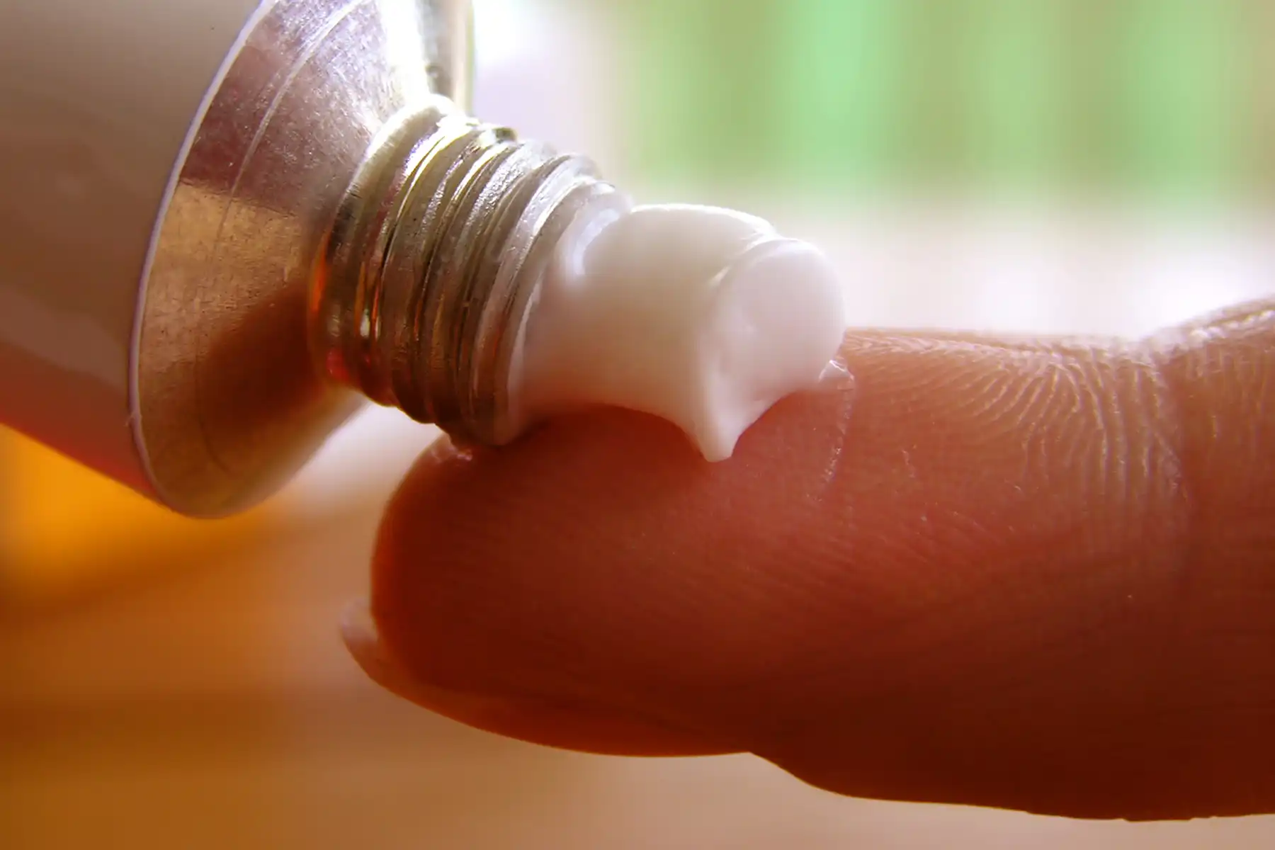 photo of medicated cream on fingertip