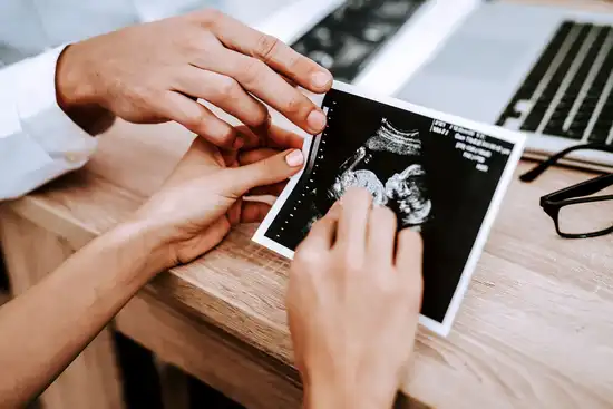 photo of pregnancy ultrasound