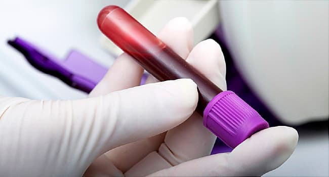 Lab-grown blood transfused to humans in UK