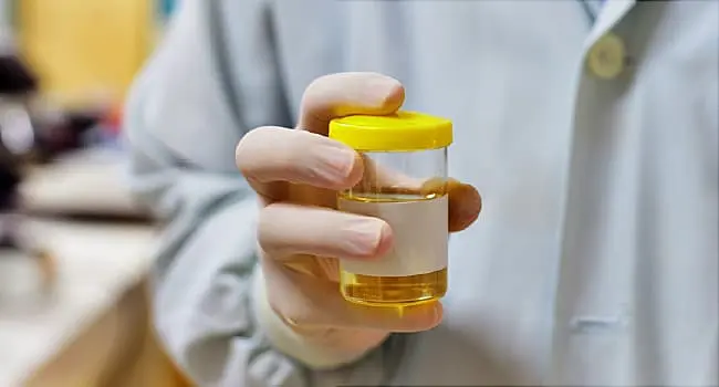 doc holding urine sample