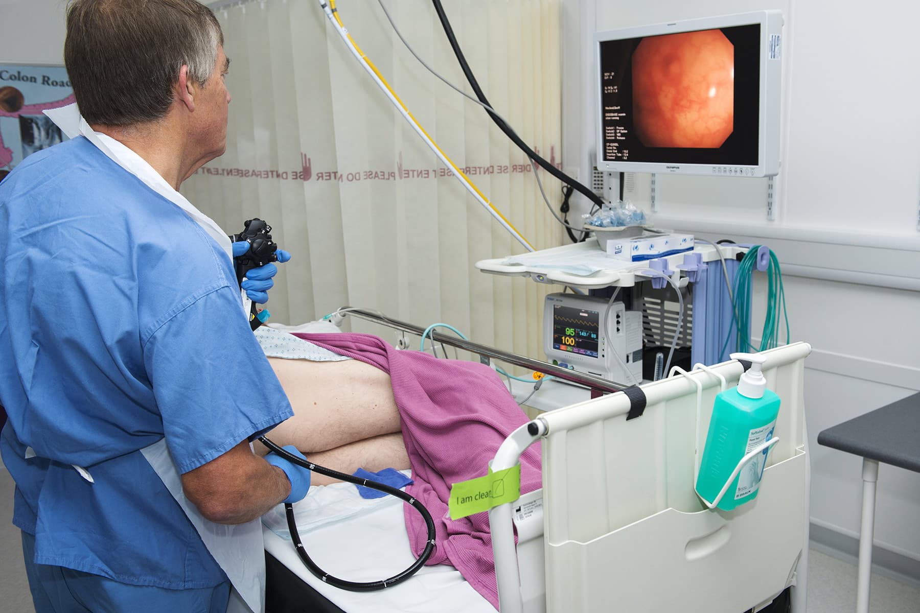 Colonoscopy Benefits Lower Than Expected, Study Shows