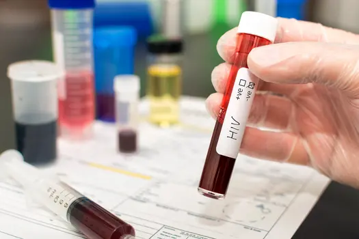 photo of test tube of blood for HIV test