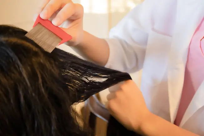 Lice Removal Is Big Business