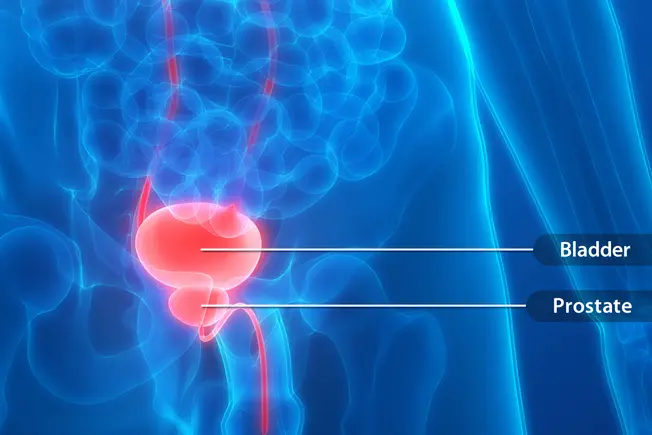 Fact: It's Not Always a Prostate Problem