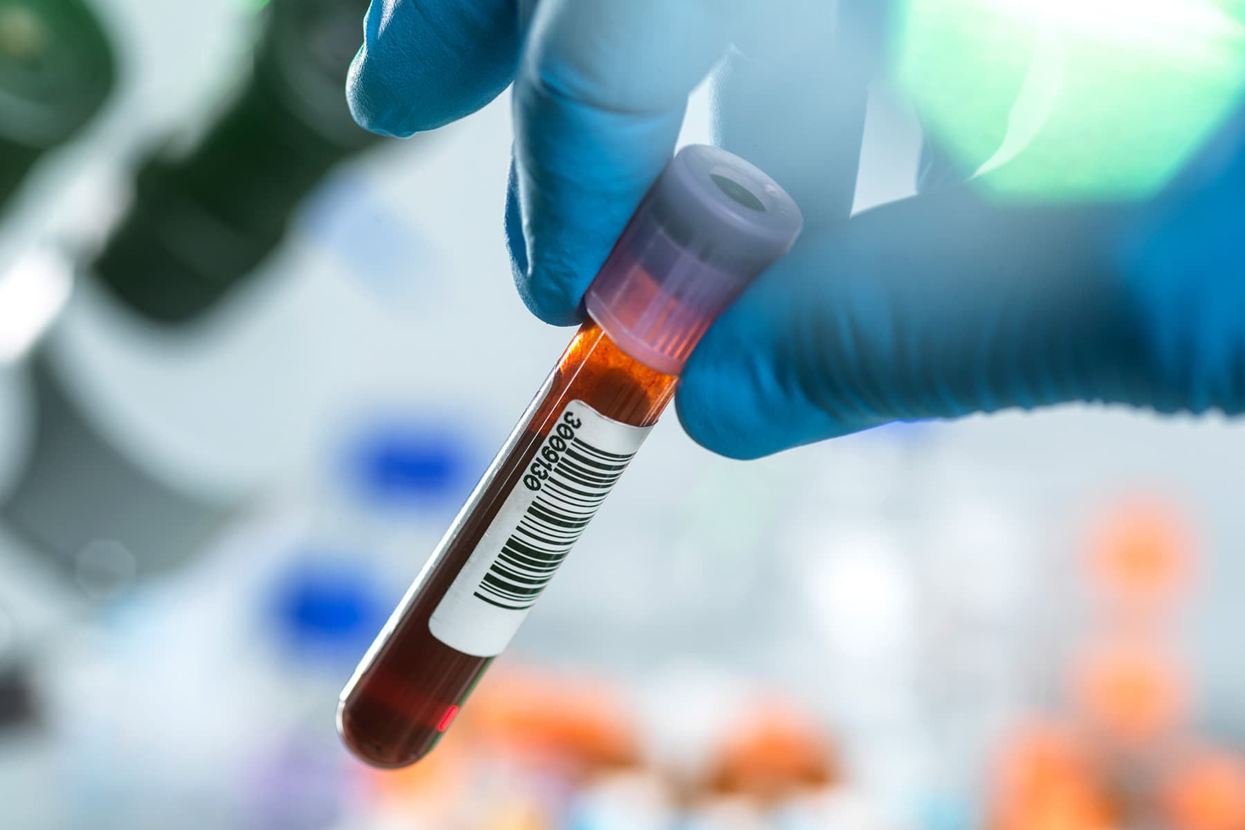 New blood test can detect Alzheimer’s disease early